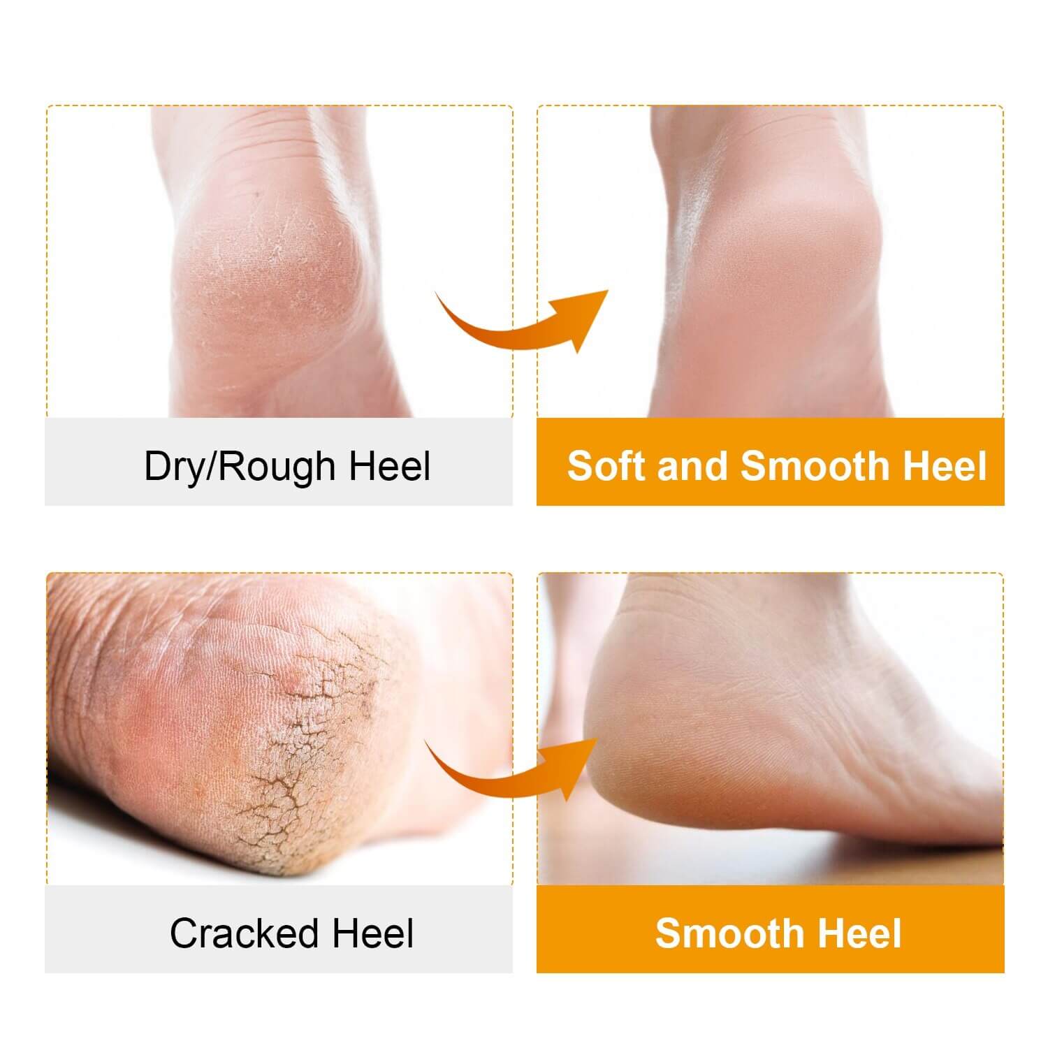 Soft Silicone Moisturizing Gel Socks for Feet – Hydrate, Protect and Revitalize | NEVADA™ - Nevada Shoe